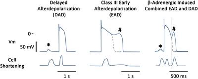 Arrhythmogenic Mechanisms in Heart Failure: Linking β-Adrenergic Stimulation, Stretch, and Calcium